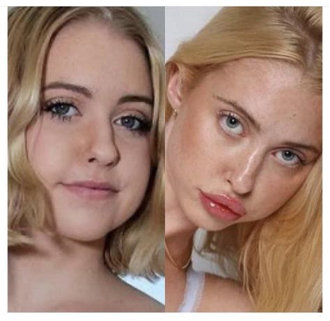 chloe cherry before lip injections|cherry longwear lipstick.